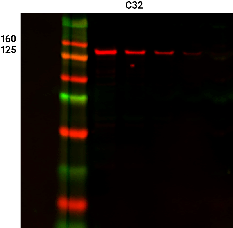 Vinculin Rabbit Monoclonal antibody detected in C32 cells