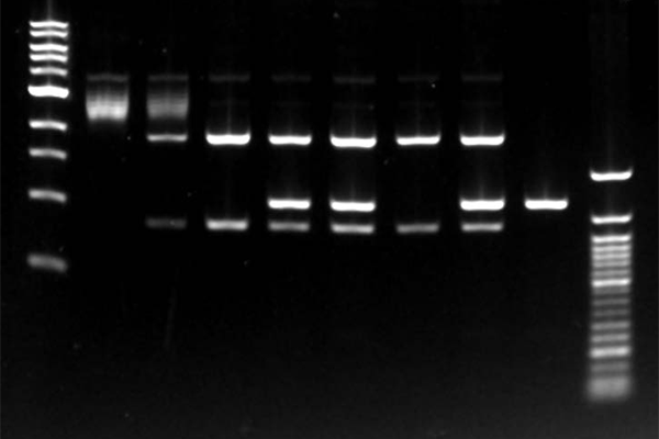 Nucleic Acid Gel Documentation