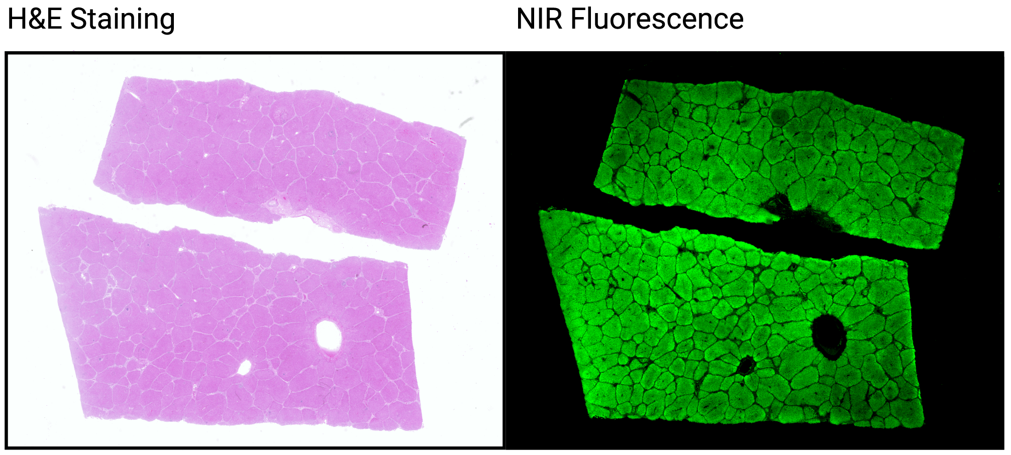 Comparison of H&E Stained slide and a fluorescent slide.